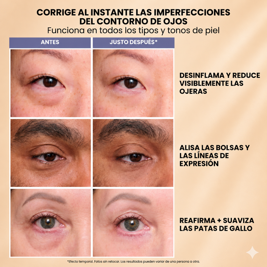 Gel tensor rejuvenecedor de ojos - LamloraLift